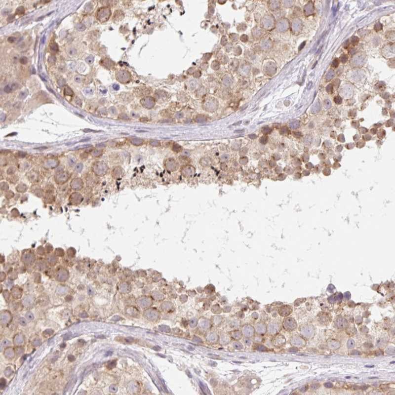 Atlas Antibodies Anti-TBPL2 Antibody