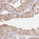 Atlas Antibodies Anti-TBPL2 Antibody