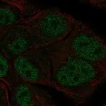Atlas Antibodies Anti-TBL1Y Antibody