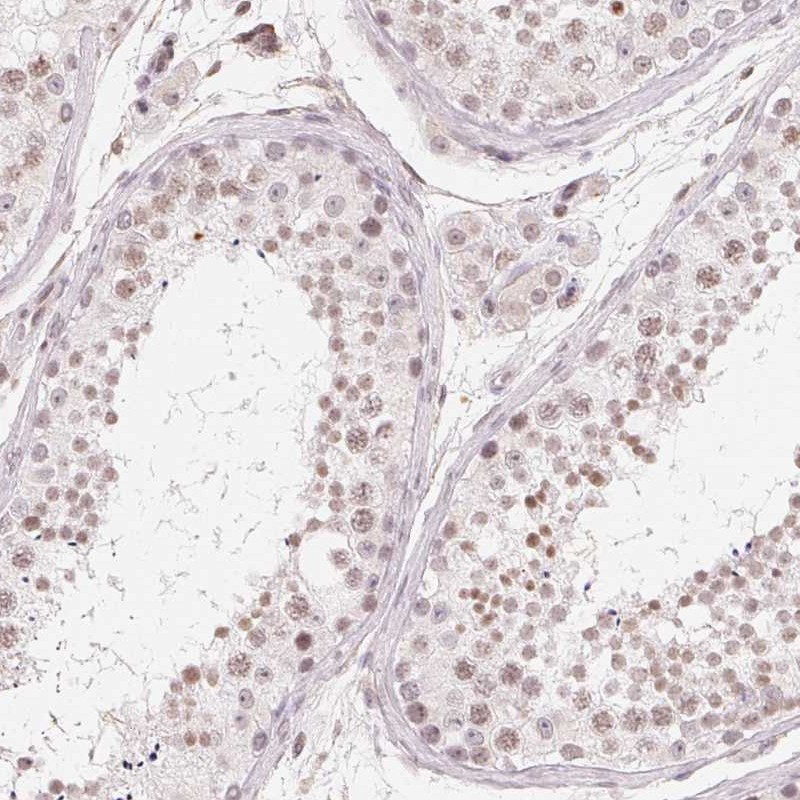 Atlas Antibodies Anti-TBP Antibody