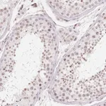 Atlas Antibodies Anti-TBP Antibody