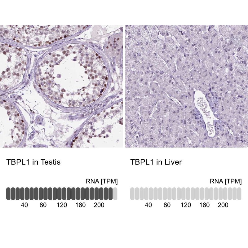 Atlas Antibodies Anti-TBPL1 Antibody