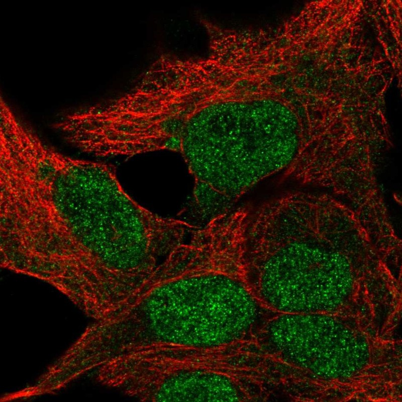 Atlas Antibodies Anti-TBPL1 Antibody