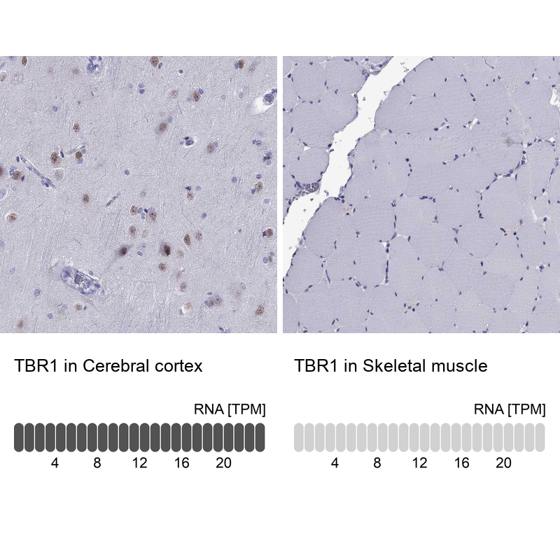 Atlas Antibodies Anti-TBR1 Antibody