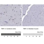 Atlas Antibodies Anti-TBR1 Antibody