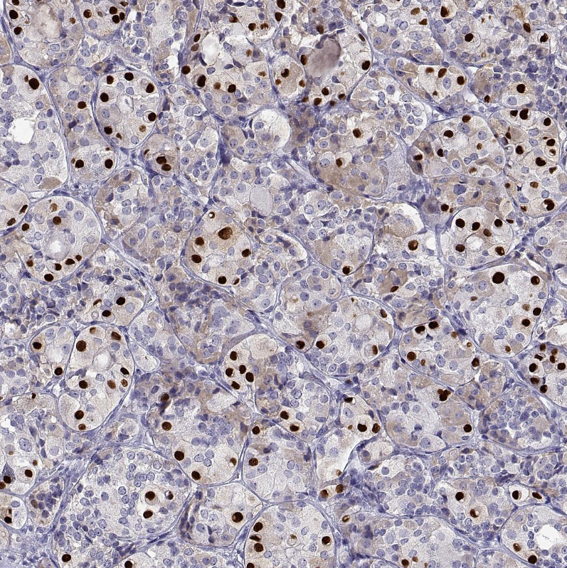Atlas Antibodies Anti-TBX19 Antibody