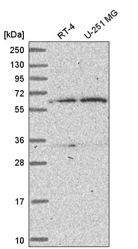Atlas Antibodies Anti-TBRG4 Antibody