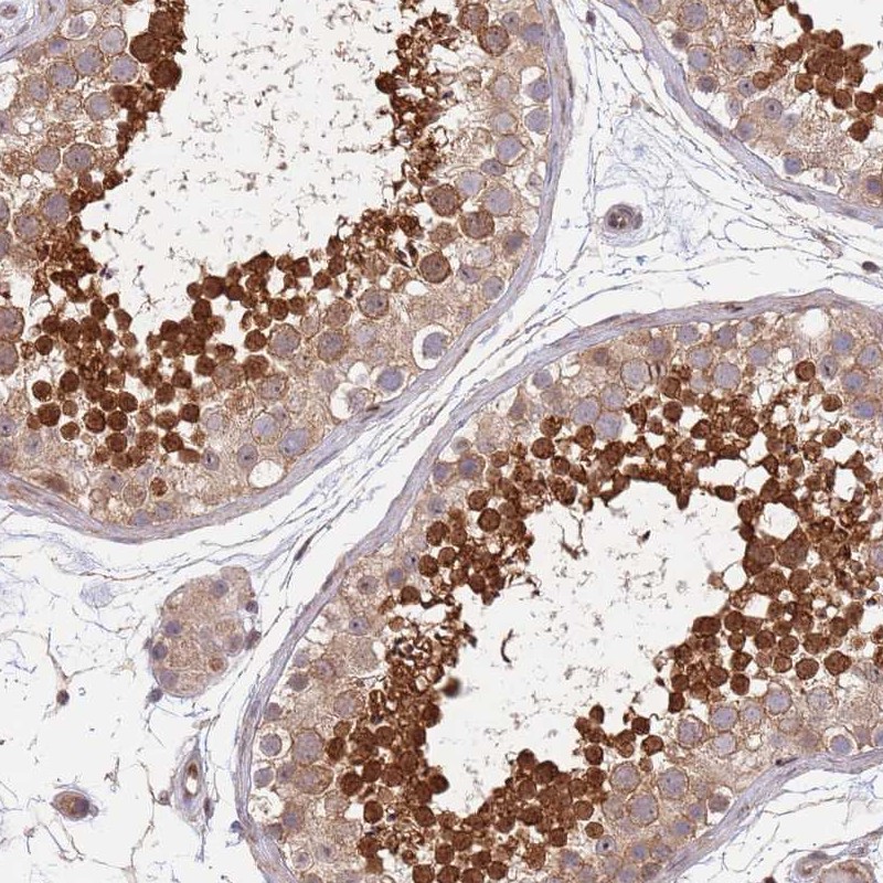 Atlas Antibodies Anti-TBX10 Antibody