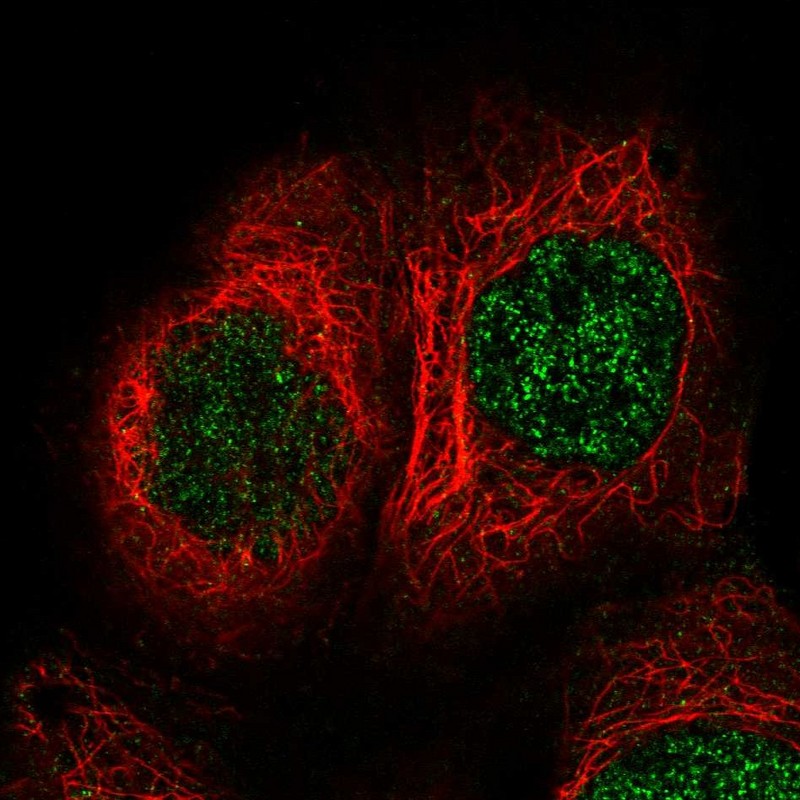 Atlas Antibodies Anti-TBRG1 Antibody
