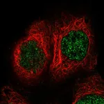 Atlas Antibodies Anti-TBRG1 Antibody