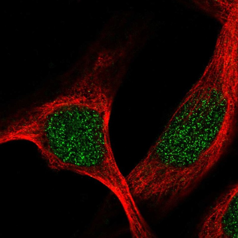 Atlas Antibodies Anti-TBRG1 Antibody
