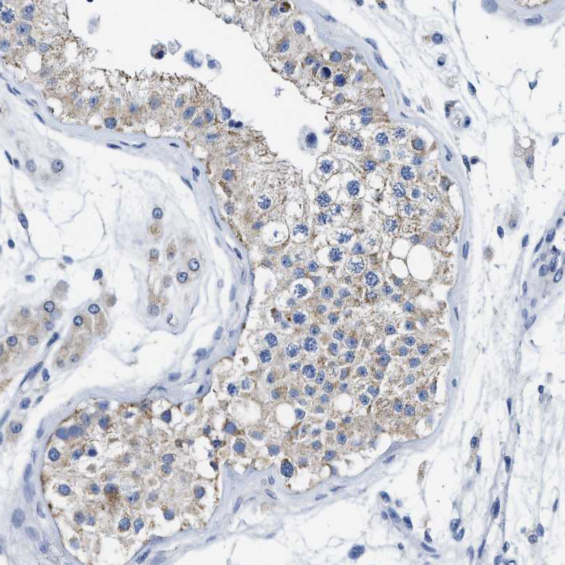 Atlas Antibodies Anti-TBRG4 Antibody