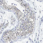 Atlas Antibodies Anti-TBRG4 Antibody
