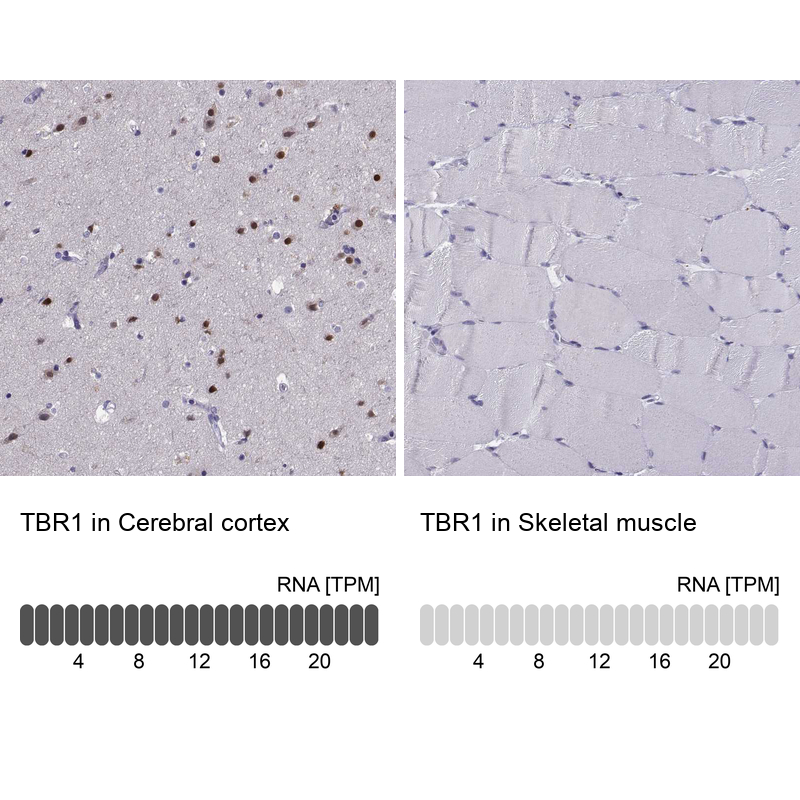 Atlas Antibodies Anti-TBR1 Antibody
