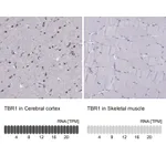 Atlas Antibodies Anti-TBR1 Antibody