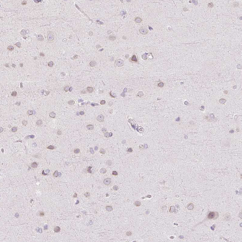 Atlas Antibodies Anti-TBX15 Antibody