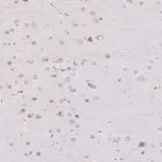 Atlas Antibodies Anti-TBX15 Antibody