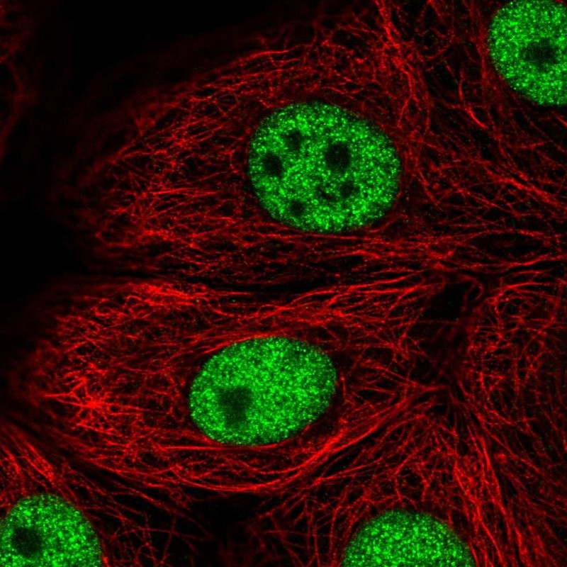 Atlas Antibodies Anti-TBX2 Antibody