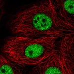 Atlas Antibodies Anti-TBX2 Antibody