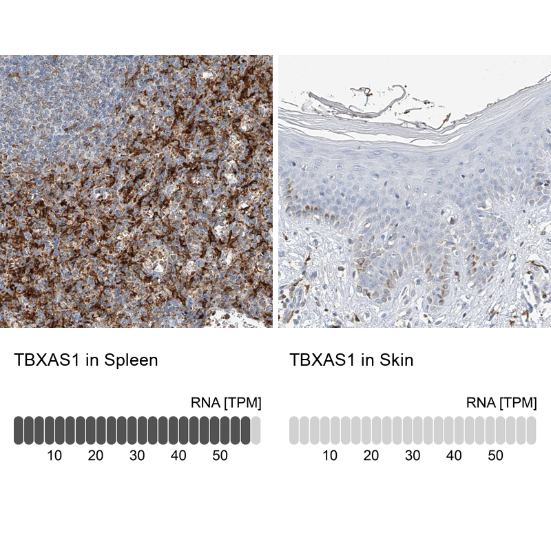 Atlas Antibodies Anti-TBXAS1 Antibody
