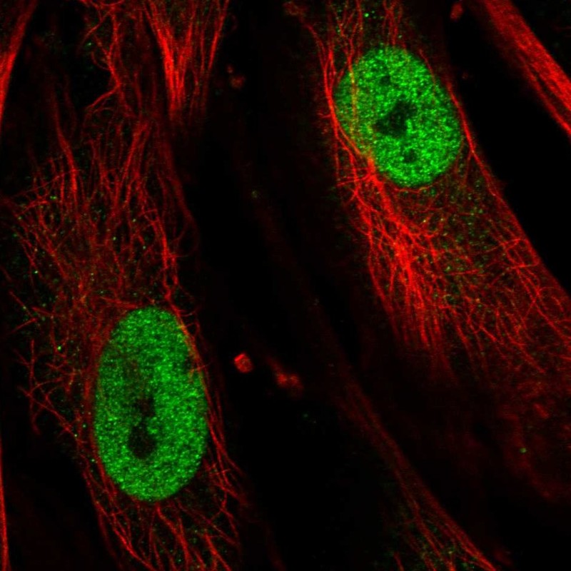 Atlas Antibodies Anti-TBX5 Antibody