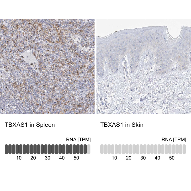 Atlas Antibodies Anti-TBXAS1 Antibody