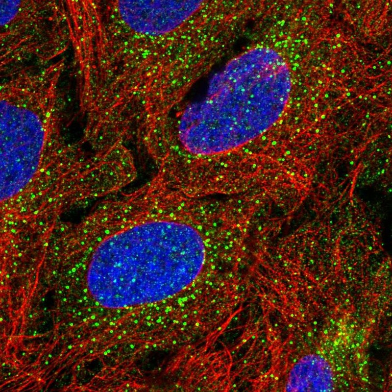 Atlas Antibodies Anti-TBX4 Antibody