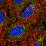 Atlas Antibodies Anti-TBX4 Antibody