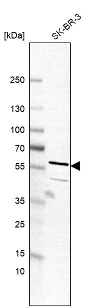 Atlas Antibodies Anti-TC2N Antibody