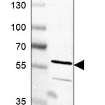 Atlas Antibodies Anti-TC2N Antibody