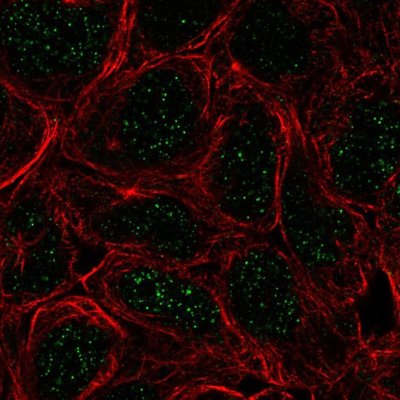 Atlas Antibodies Anti-TBX6 Antibody