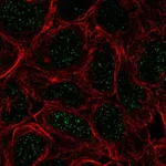 Atlas Antibodies Anti-TBX6 Antibody