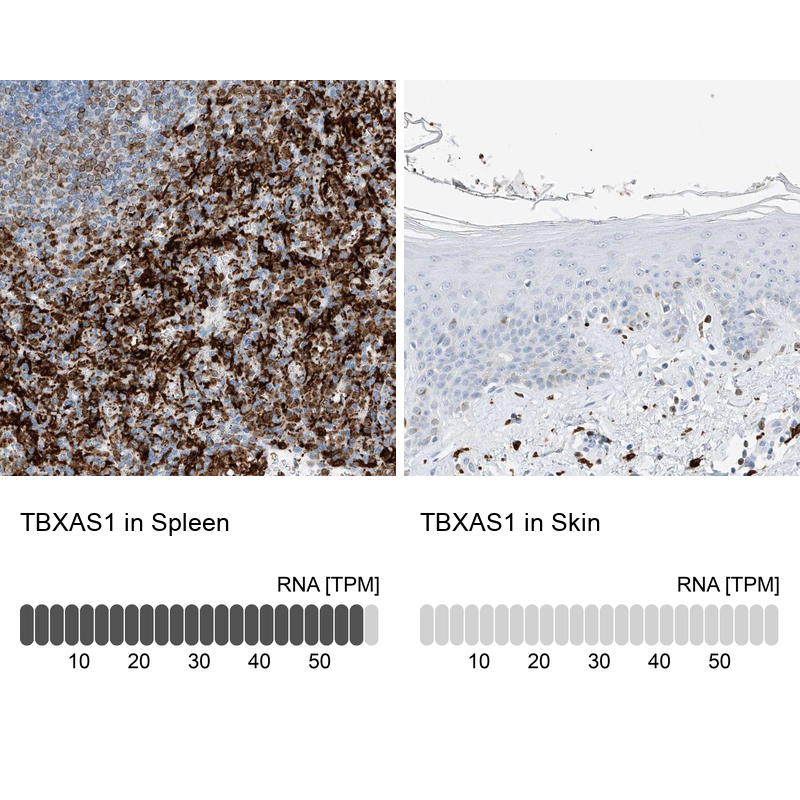 Atlas Antibodies Anti-TBXAS1 Antibody