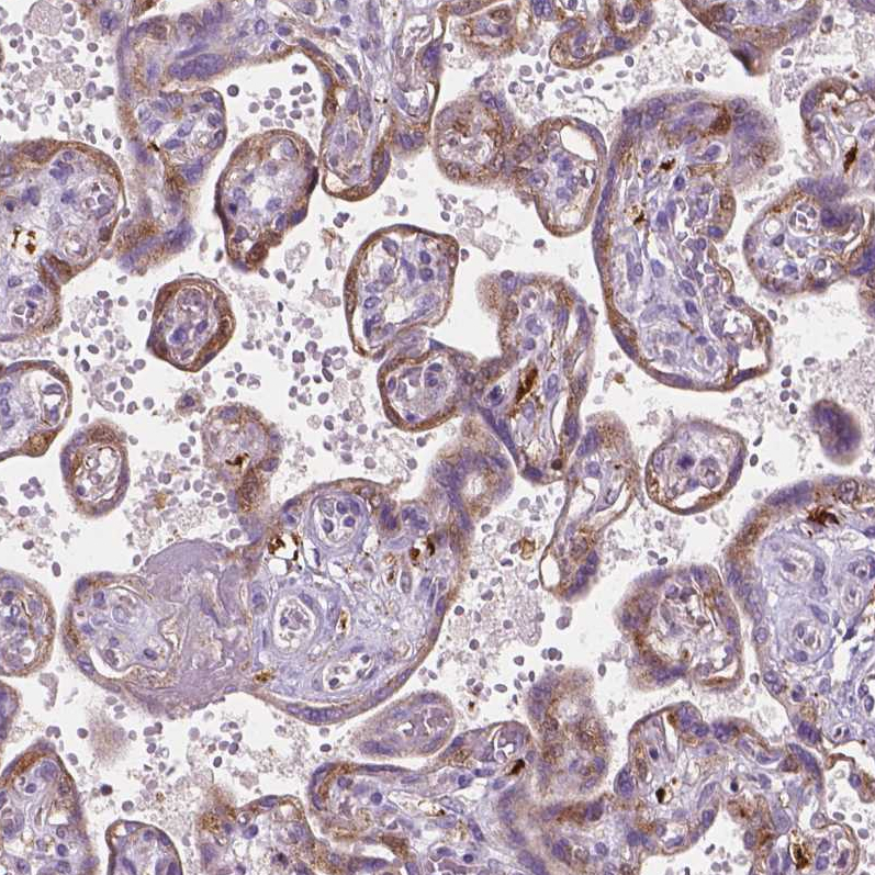 Atlas Antibodies Anti-TCAF1 Antibody