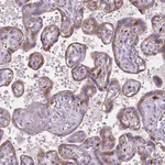 Atlas Antibodies Anti-TCAF1 Antibody