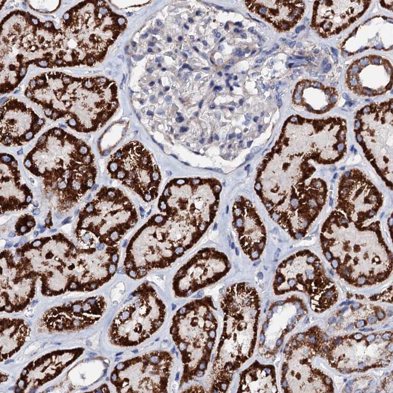 Atlas Antibodies Anti-TCAF2 Antibody