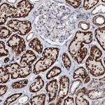 Atlas Antibodies Anti-TCAF2 Antibody