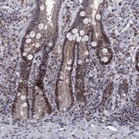 Atlas Antibodies Anti-TCEAL1 Antibody