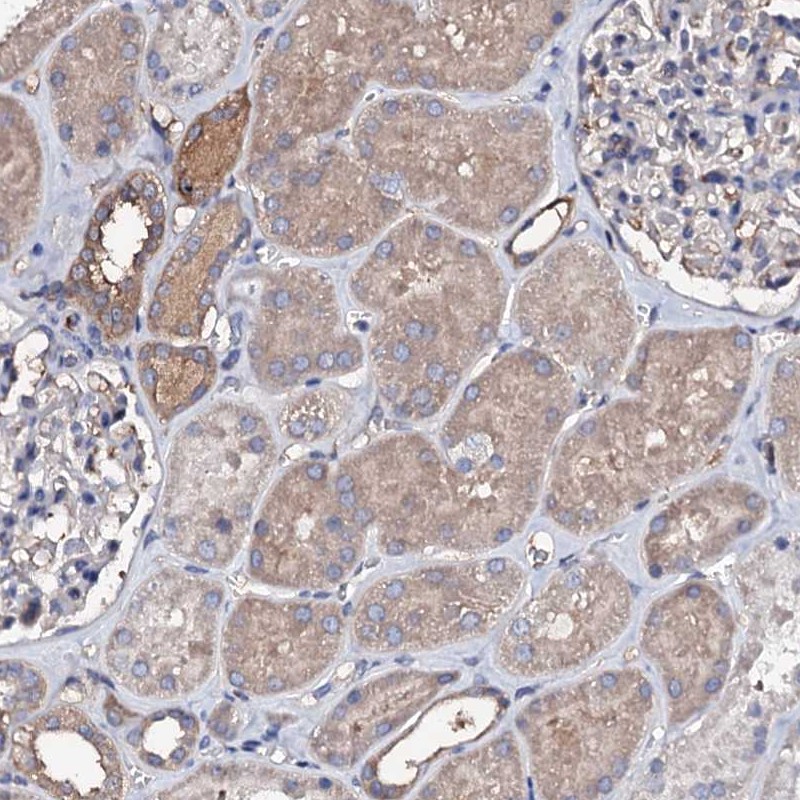 Atlas Antibodies Anti-TCAF2 Antibody