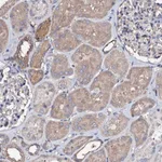 Atlas Antibodies Anti-TCAF2 Antibody