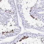 Atlas Antibodies Anti-TCEAL3 Antibody
