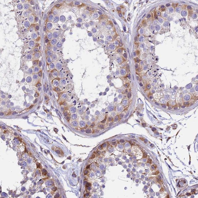 Atlas Antibodies Anti-TCEAL5 Antibody