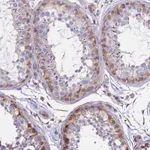 Atlas Antibodies Anti-TCEAL5 Antibody
