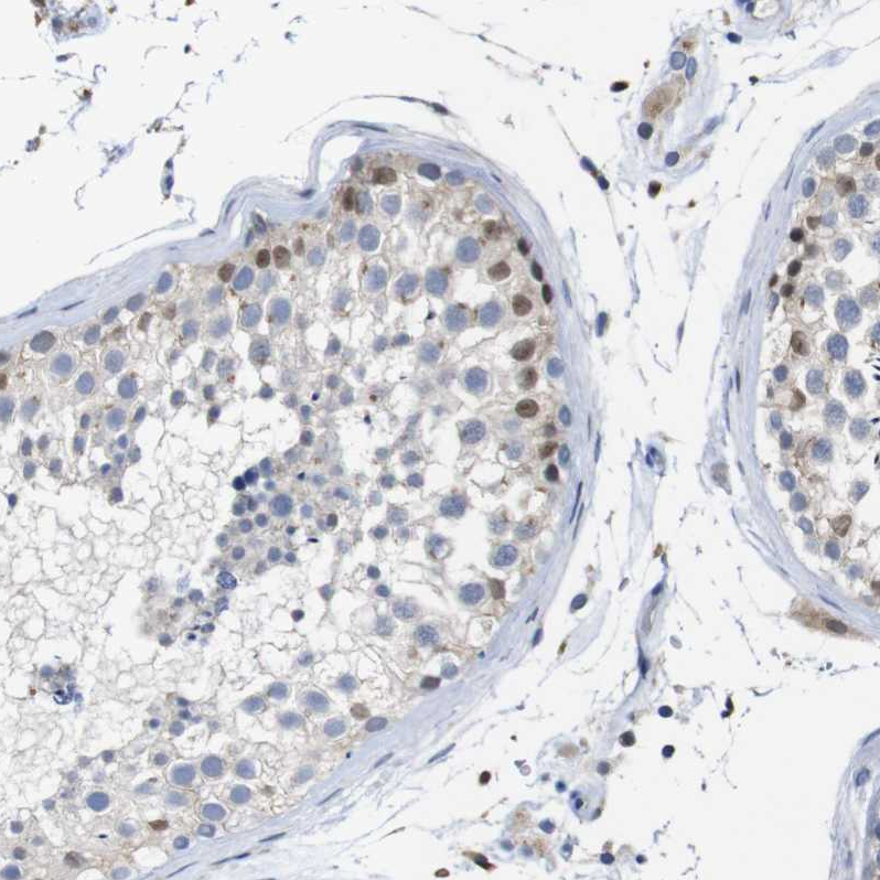 Atlas Antibodies Anti-TCEAL9 Antibody