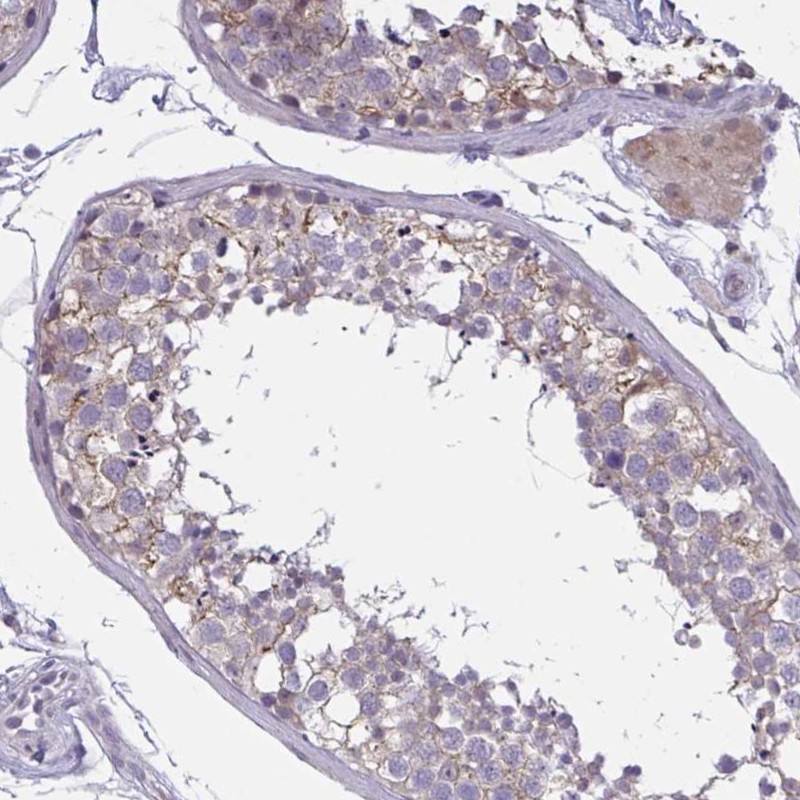Atlas Antibodies Anti-TCEAL8 Antibody