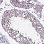 Atlas Antibodies Anti-TCEAL8 Antibody