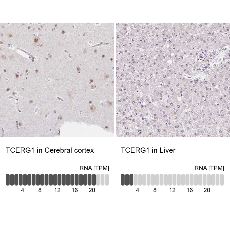 Atlas Antibodies Anti-TCERG1 Antibody