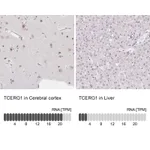Atlas Antibodies Anti-TCERG1 Antibody