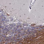 Atlas Antibodies Anti-TCEANC2 Antibody