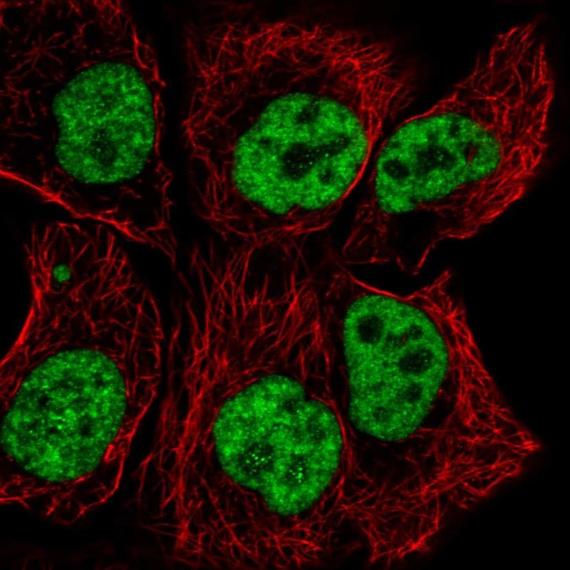 Atlas Antibodies Anti-TCERG1 Antibody